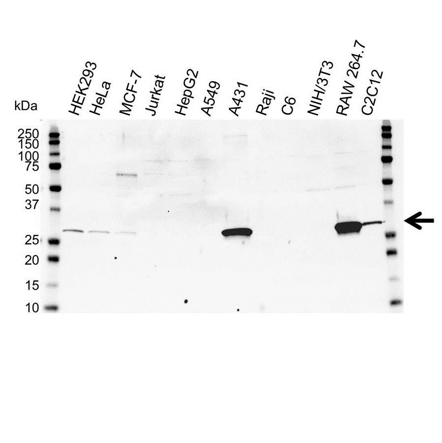 Anti Carbonic Anhydrase II Antibody (PrecisionAb Polyclonal Antibody) gallery image 1