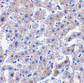 Anti Caspase-14 (C-Terminal) Antibody gallery image 2