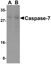 Anti Caspase-7 (N-Terminal) Antibody gallery image 1
