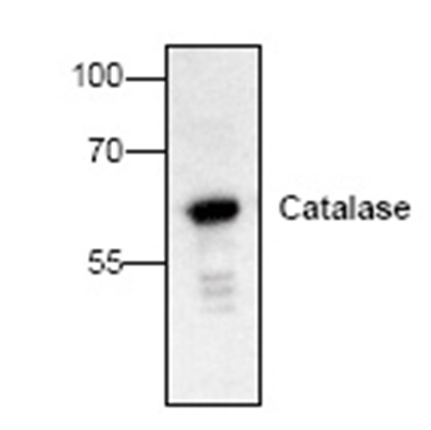 Anti Catalase Antibody gallery image 1
