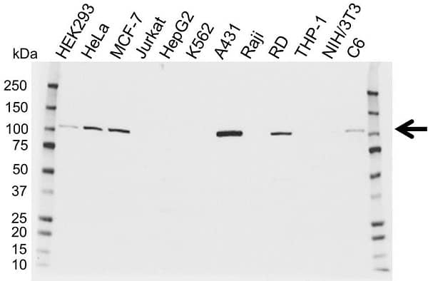 Anti Catenin Alpha 1 Antibody (PrecisionAb Polyclonal Antibody) gallery image 1