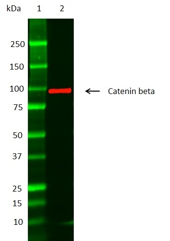 Anti Catenin Beta Antibody gallery image 2