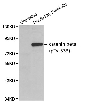 Anti Catenin Beta (pTyr333) Antibody gallery image 1