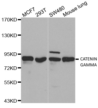 Anti Catenin Gamma Antibody gallery image 1