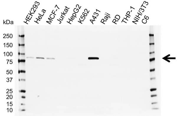 Anti Catenin Gamma Antibody (PrecisionAb Polyclonal Antibody) gallery image 1
