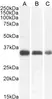Anti Cathepsin B Antibody thumbnail image 1