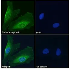 Anti Cathepsin B Antibody gallery image 2