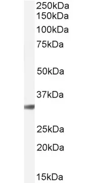Anti Cathepsin B Antibody gallery image 4