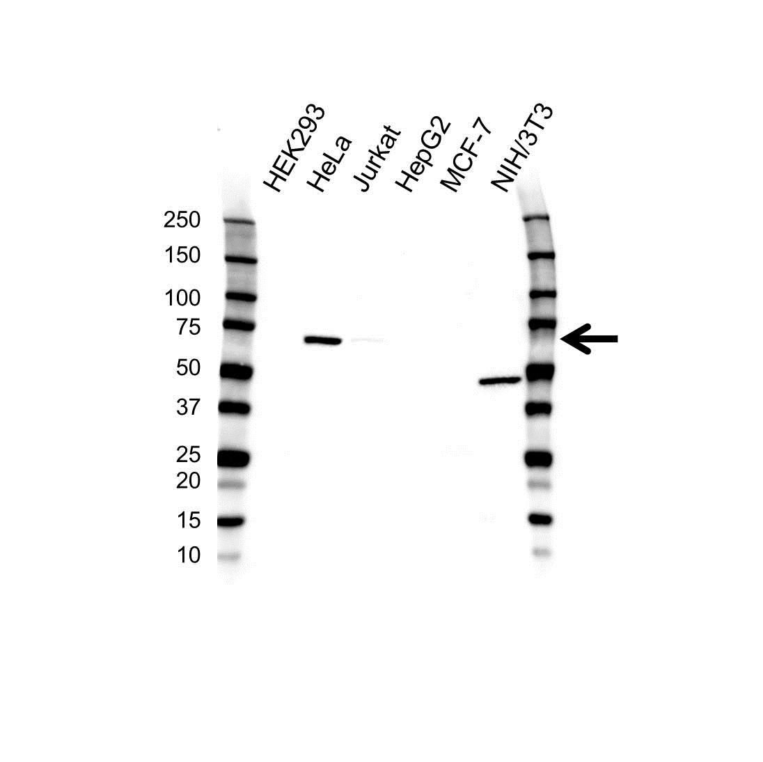 Anti CBFA2T2 Antibody (PrecisionAb Polyclonal Antibody) gallery image 1