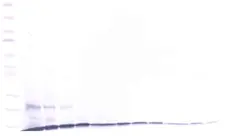 Anti Human CCL23 Antibody gallery image 1