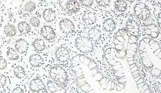 Anti Human CCL25 Antibody gallery image 1
