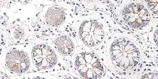 Anti Human CCL25 Antibody gallery image 2