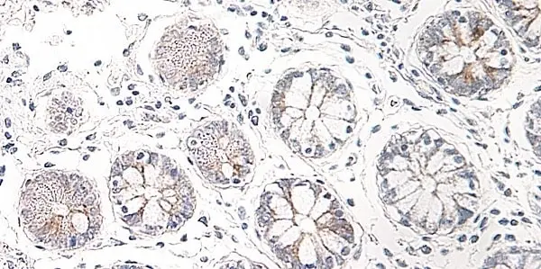 Anti Human CCL25 Antibody gallery image 2
