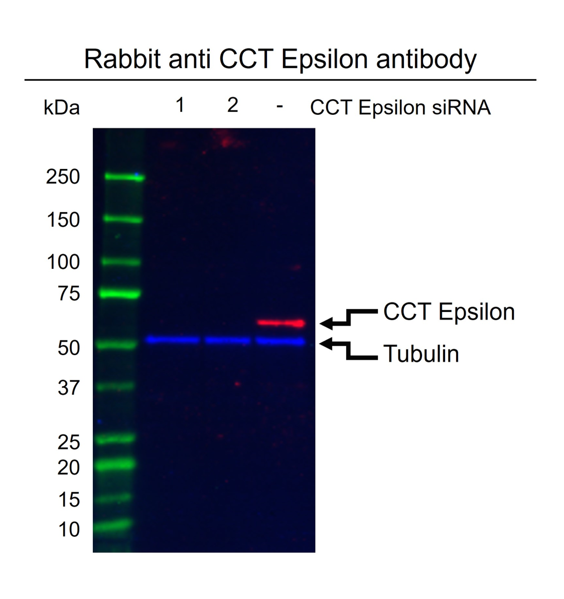 Anti CCT Epsilon Antibody (PrecisionAb Polyclonal Antibody) gallery image 2