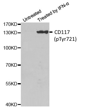 Anti CD117 (pTyr721) Antibody gallery image 1