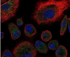 Anti Human CD120b Antibody gallery image 1