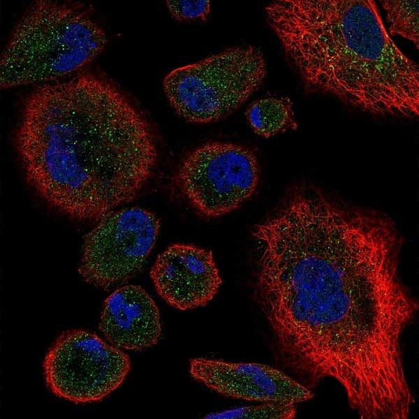 Anti Human CD120b Antibody gallery image 1