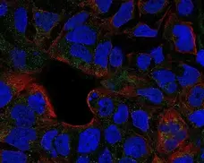 Anti Human CD120b Antibody gallery image 2