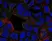 Anti Human CD120b Antibody thumbnail image 2