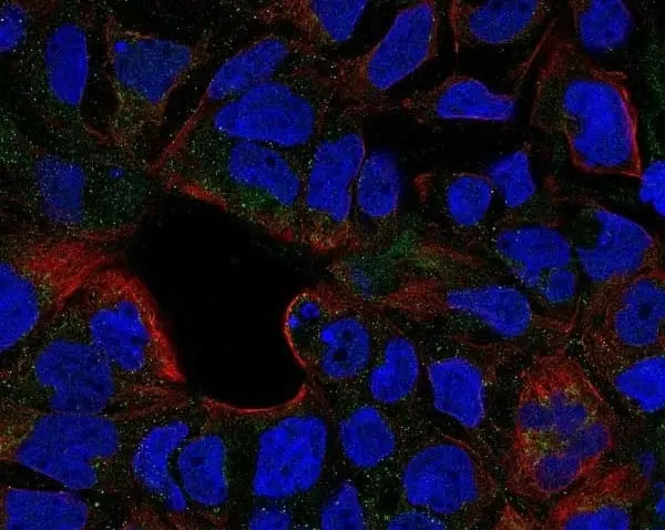 Anti Human CD120b Antibody gallery image 2