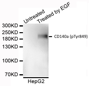 Anti CD140a (pTyr849) Antibody gallery image 1