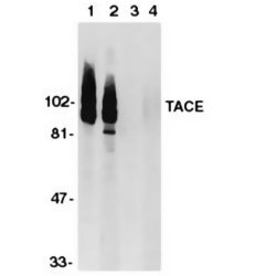 Anti Human CD156b (C-Terminal) Antibody gallery image 1