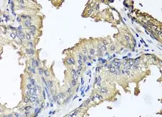 Anti CD184 / CXCR4 Antibody gallery image 2