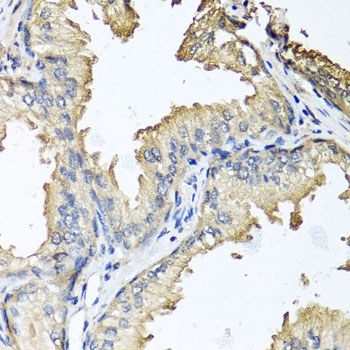 Anti CD184 / CXCR4 Antibody gallery image 2