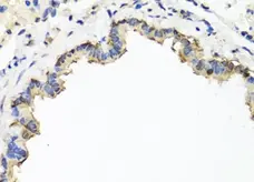 Anti CD184 / CXCR4 Antibody gallery image 3