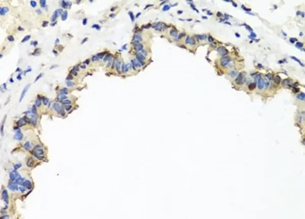 Anti CD184 / CXCR4 Antibody gallery image 3