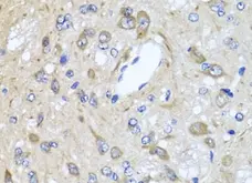 Anti CD184 / CXCR4 Antibody gallery image 4