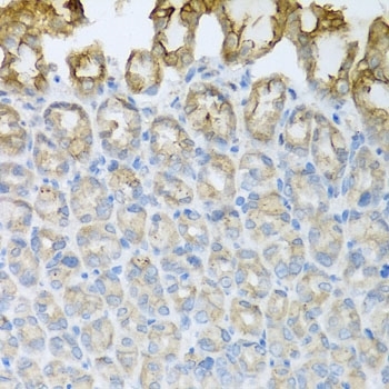 Anti CD184 / CXCR4 Antibody gallery image 5