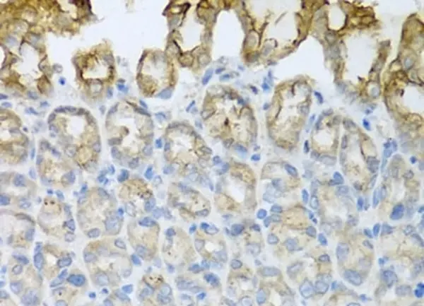 Anti CD184 / CXCR4 Antibody gallery image 5