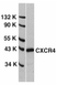 Anti Human CD184 / CXCR4 Antibody thumbnail image 1