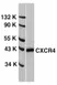 Anti Human CD184 / CXCR4 Antibody thumbnail image 1