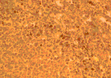 Anti Human CD192 (N-Terminal) Antibody gallery image 1