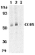 Anti Human CD193 Antibody thumbnail image 1