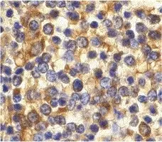 Anti Human CD193 Antibody gallery image 2