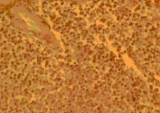 Anti Human CD194 Antibody gallery image 1