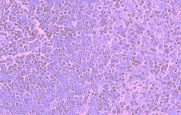 Anti Human CD195 (N-Terminal) Antibody (Polyclonal Antibody Antibody) gallery image 1
