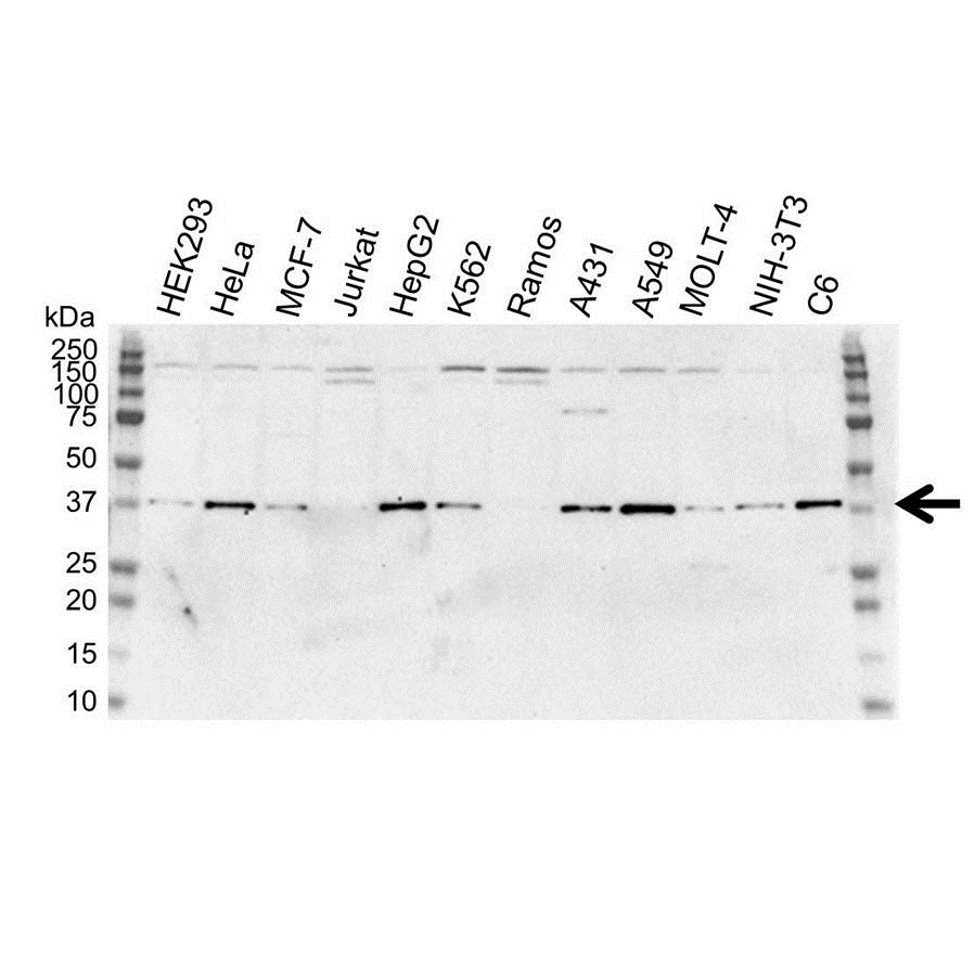 Anti Human CD195 (N-Terminal) Antibody (Polyclonal Antibody Antibody) gallery image 2