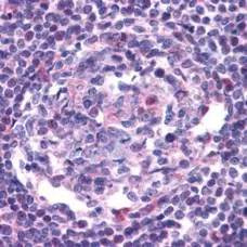 Anti Human CD195 (CCR5) Antibody gallery image 1