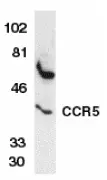 Anti Human CD195 (CCR5) Antibody gallery image 2