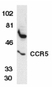 Anti Human CD195 (CCR5) Antibody thumbnail image 2
