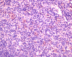 Anti Human CD196 Antibody thumbnail image 1