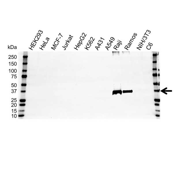 Anti CD20 Antibody (PrecisionAb Polyclonal Antibody) gallery image 1