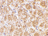 Anti Human CD234 (C-Terminal) Antibody gallery image 2