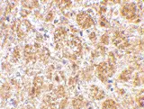 Anti Human CD234 (C-Terminal) Antibody gallery image 2