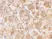 Anti Human CD234 (C-Terminal) Antibody thumbnail image 2