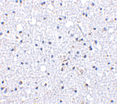 Anti Human CD234 (N-Terminal) Antibody gallery image 2